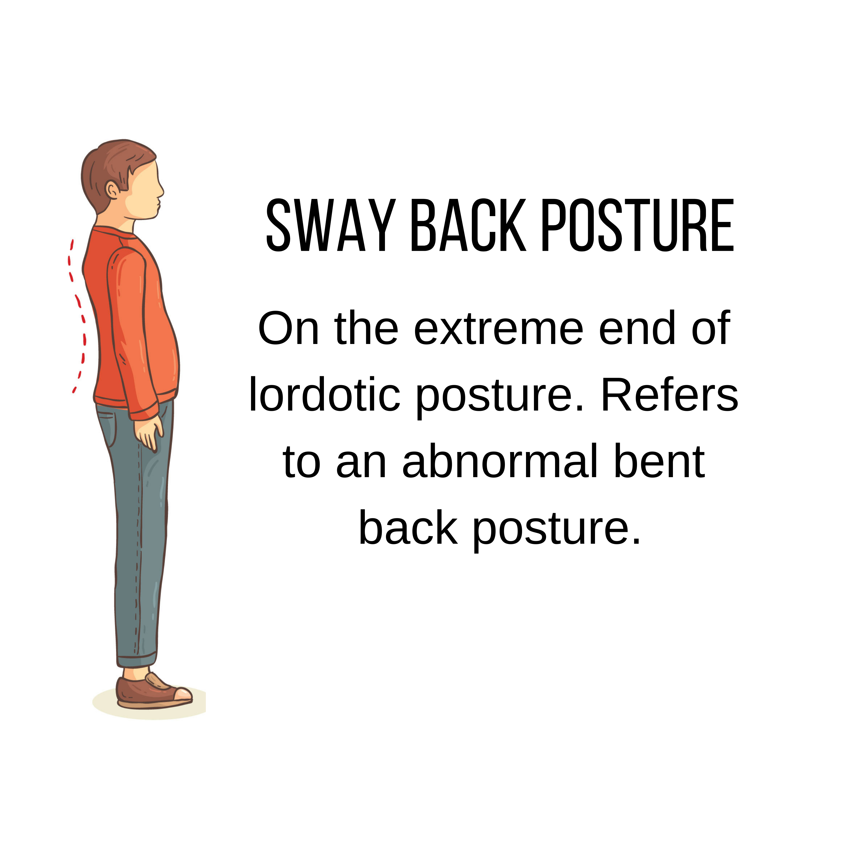 Swayback Posture - How To Regain Balance